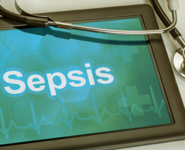 sepsis surveillance