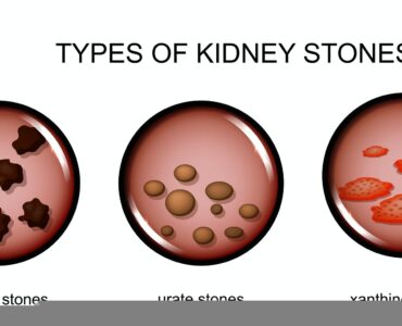 urologist in New York