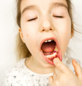 Orthodontics for Kids: When Is the Right Time to Start?