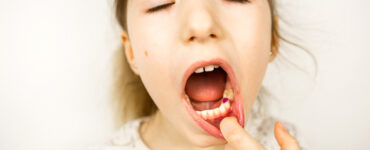 Orthodontics for Kids: When Is the Right Time to Start?