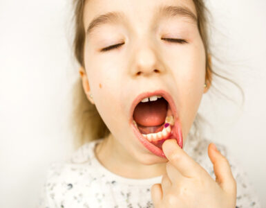 Orthodontics for Kids: When Is the Right Time to Start?