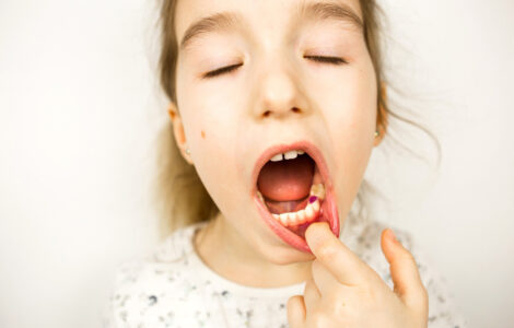 Orthodontics for Kids: When Is the Right Time to Start?